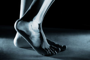 The Ankle: A Deep Dive into its Effect on Skiing (1 CEU)