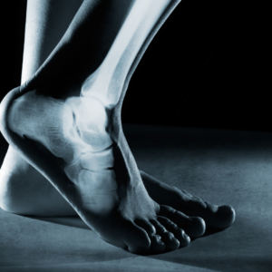 The Ankle: A Deep Dive into its Effect on Skiing (1 CEU)
